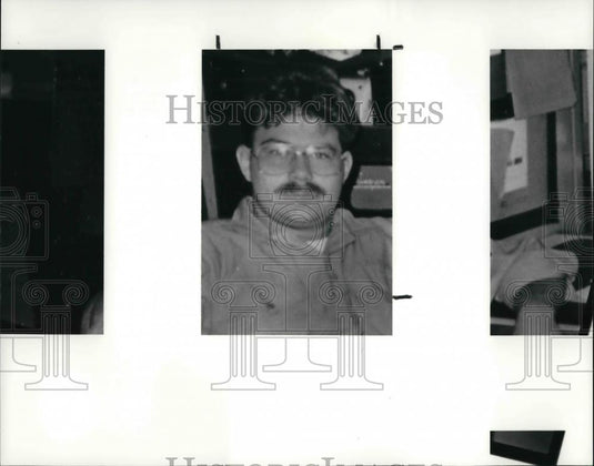 1988 Press Photo Stanley Lawson Jr. injured by explosion - Historic Images