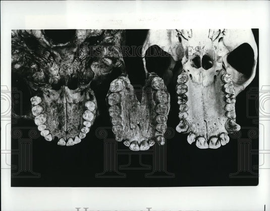 1979 Press Photo The teeth in the modern chimpanzee's skull - Historic Images