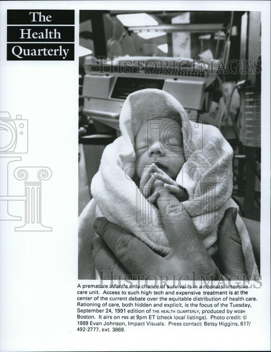 Press Photo A premature baby in a neonatal intensive care unit - Historic Images