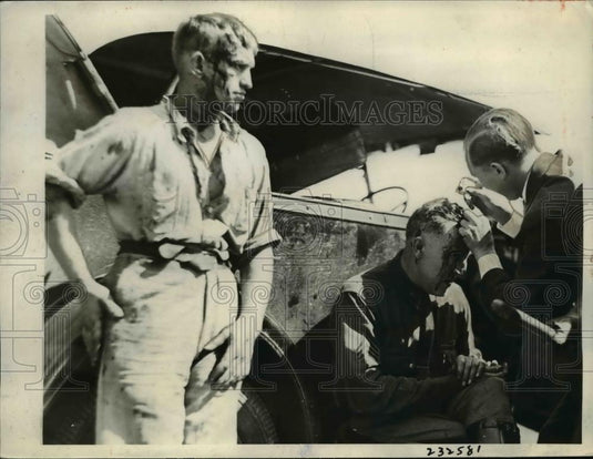 1933 Press Photo First aid treatment is recieved by Striker Jake Myers - Historic Images