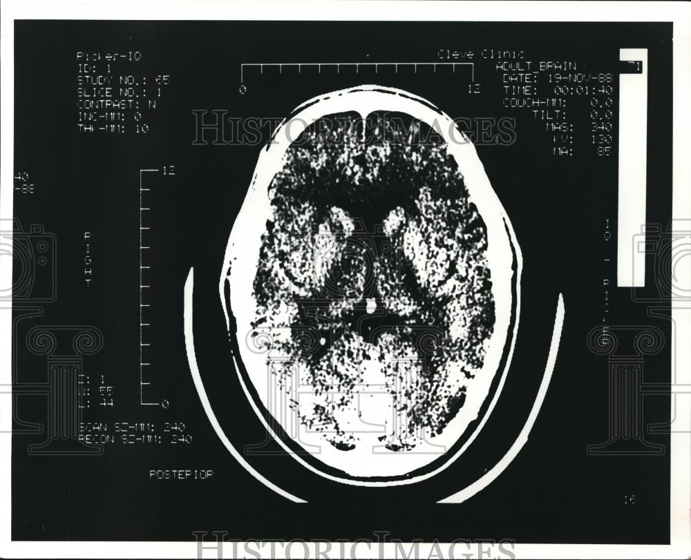 1981 Press Photo IQ Scanner by Picker International Corp - Historic Images