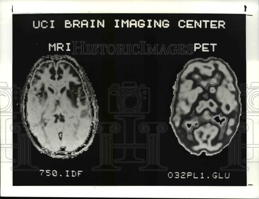 1987 Press Photo Pet Brain CT Scan Example - 530 - Historic Images