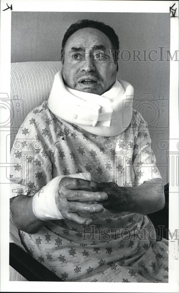 1986 Press Photo Joseph Najfach at the Mt. Sinai Medical center for his burns - Historic Images