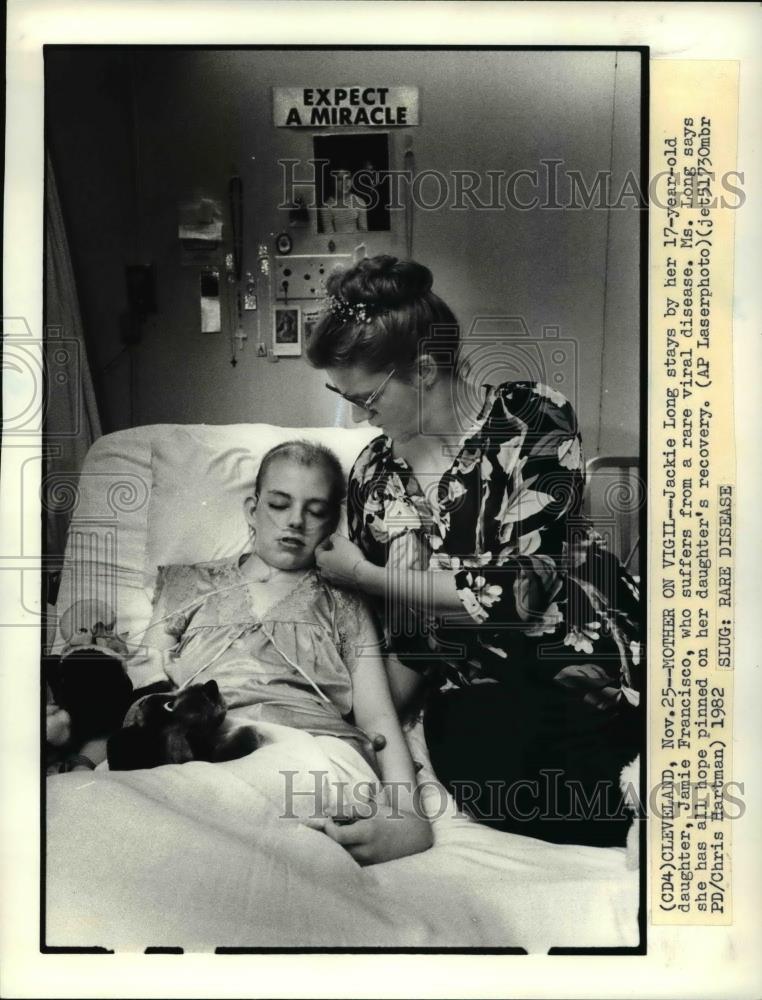 1982 Press Photo Jackie Long & daughter Jamie Francisco with rare viral disease - Historic Images