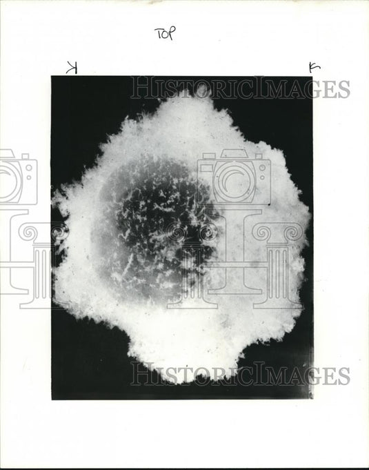 1984 Press Photo Chorion surrounds the gestational sac when a woman is pregnant - Historic Images