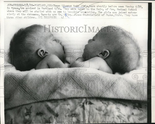 1959 Press Photo Siamese twins Girls of Mrs. James Stubblefield - Historic Images
