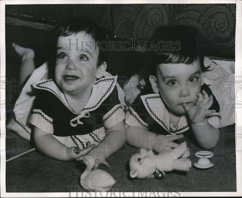 1955 Press Photo Nancy and Ellen were joined by the breastbone - Historic Images