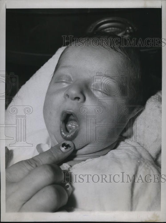 1946 Press Photo Patricia Carol Ferolo has two teeth at the early age of 4 days - Historic Images