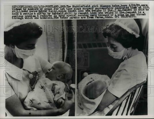 1959 Press Photo of the  twin girls that were successfully separated in Oregon. - Historic Images
