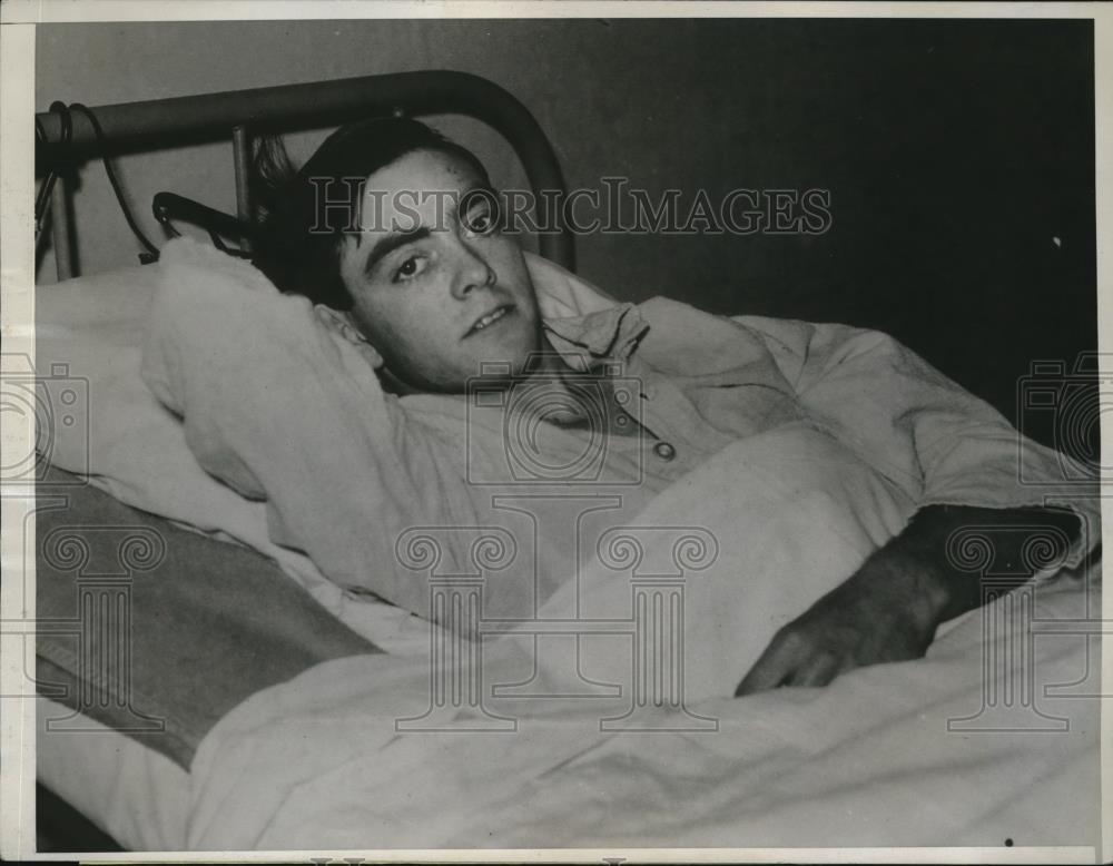 1934 Press Photo Iowa Man John Wilson After Leg Amputation - Historic Images