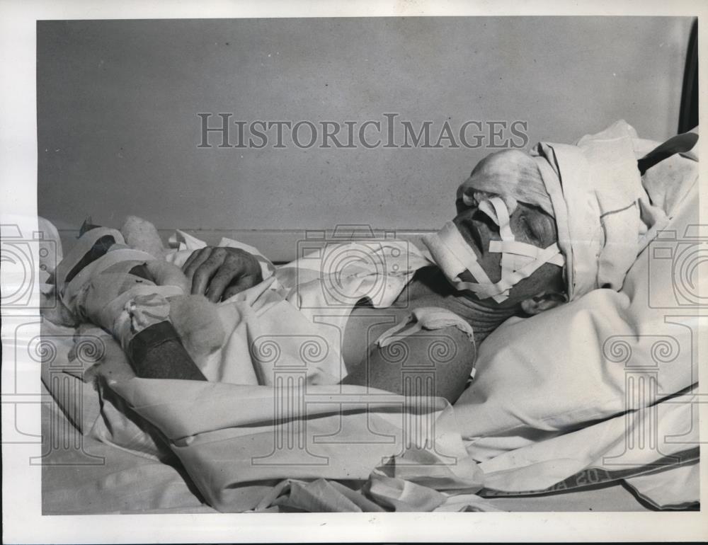 1947 Press Photo Helen Kayne of Los Angeles Injured in Car Accident - Historic Images