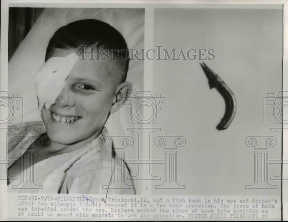 1954 Press Photo Roman Trzcinski has a fish hook embedded into his eye - Historic Images