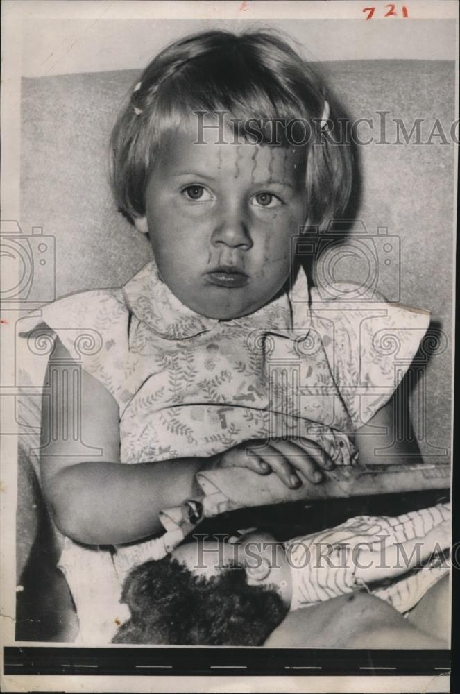 1958 Press Photo Toddler Girl Ronna Casteel After Car Ran Over Head - Historic Images