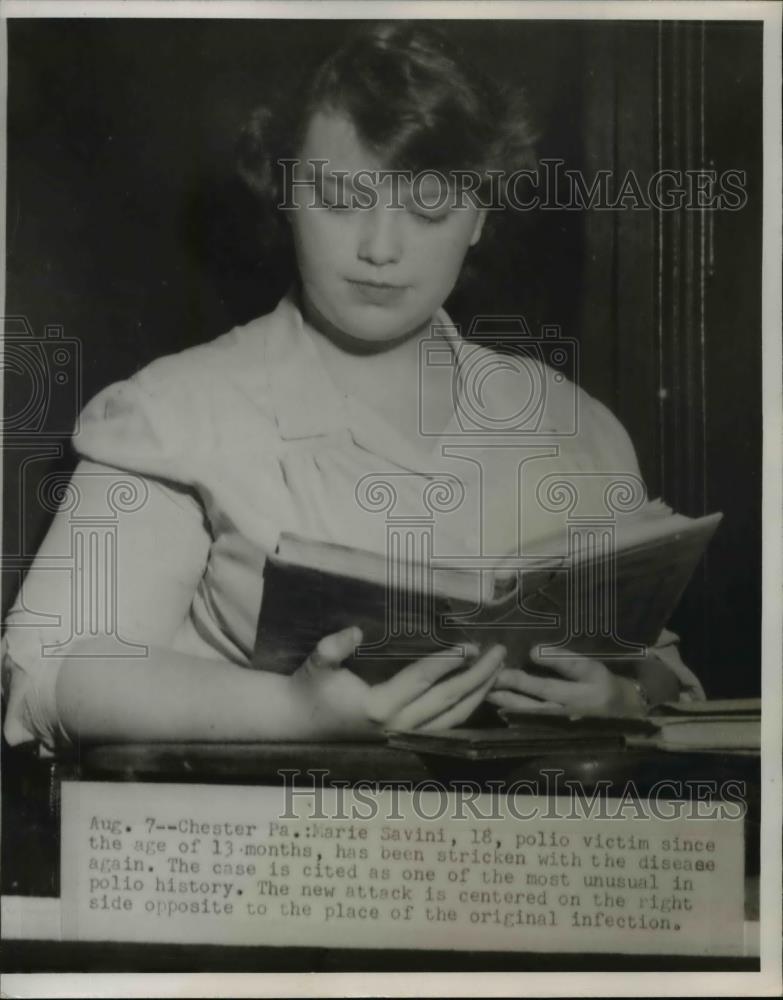 1952 Press Photo Marie Savini, polo victim since a baby - Historic Images