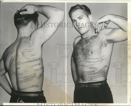 1941 Press Photo Max Caldwell shows welts given by Hilda Rhodes & Aldythea Keith - Historic Images