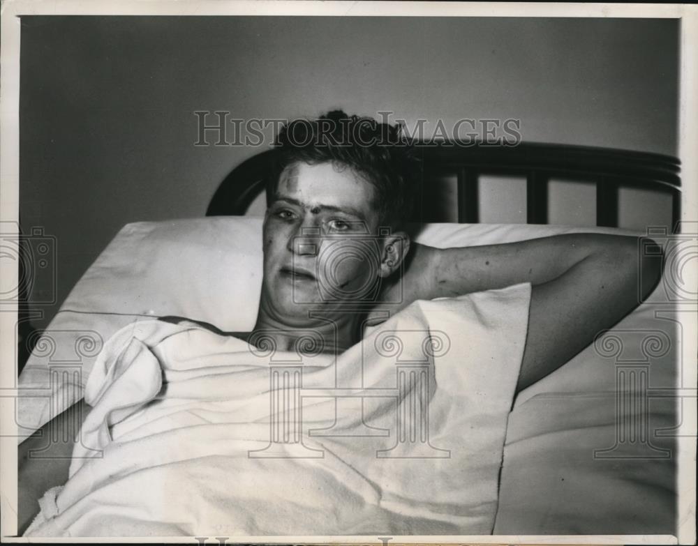 1948 Press Photo Gerald Ames,car crash survivor, in the hospital for treatment - Historic Images