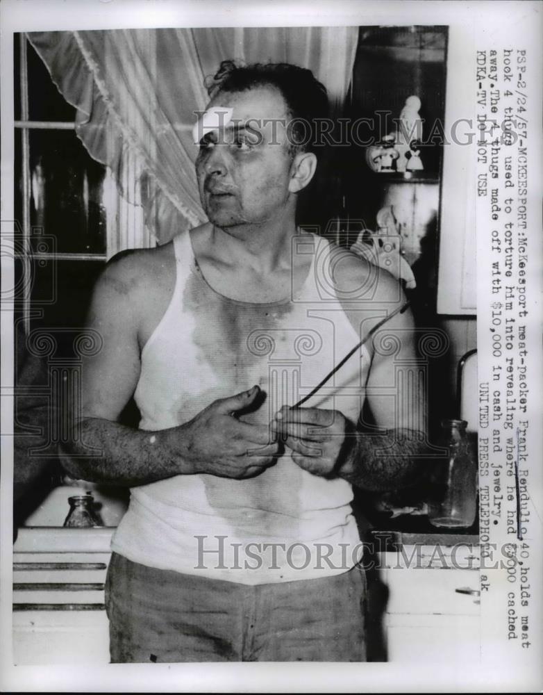 1957 Press Photo Frank Rendulio was tortured by 4 thgs to reveal his cache - Historic Images