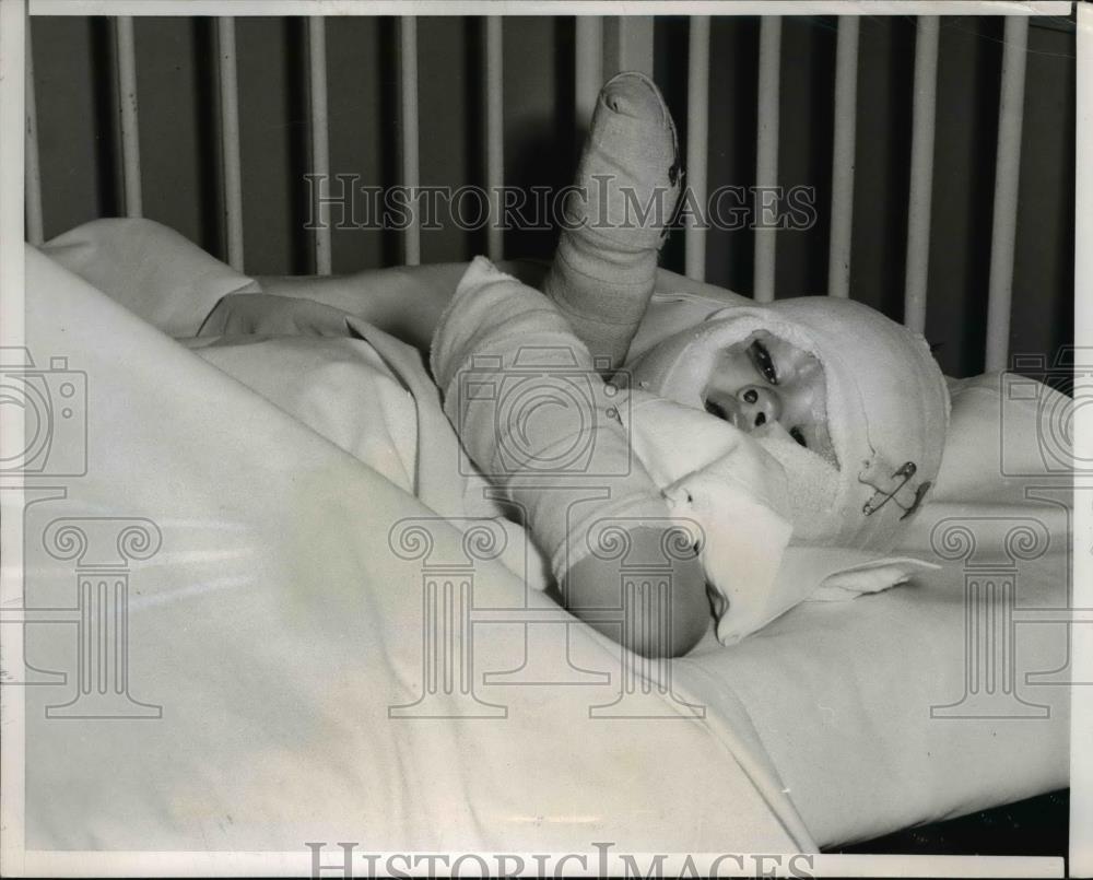 1956 Press Photo Michael Downs Wrapped in Bandages After Burned in Home Fire - Historic Images