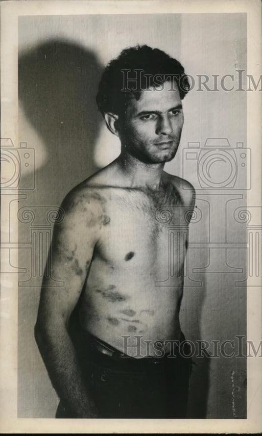 1940 Press Photo Montesamo Washington, Henry Chum Tortured By Frank W Chase. - Historic Images