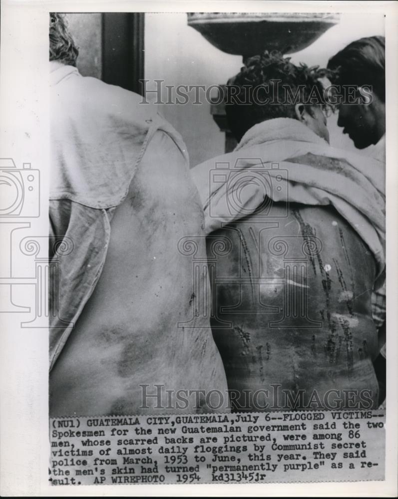 1954 Press Photo Two of the 86 flogged victims by the communist secret police - Historic Images