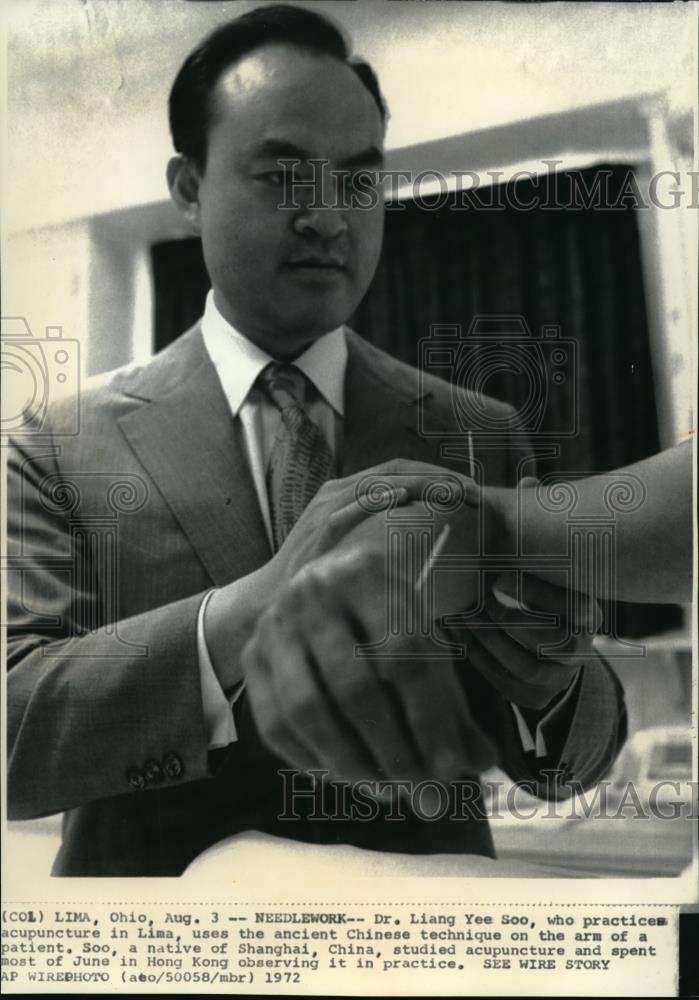 1972 Press Photo Dr. Liang Yee Soo practices acupuncture in Lima - Historic Images