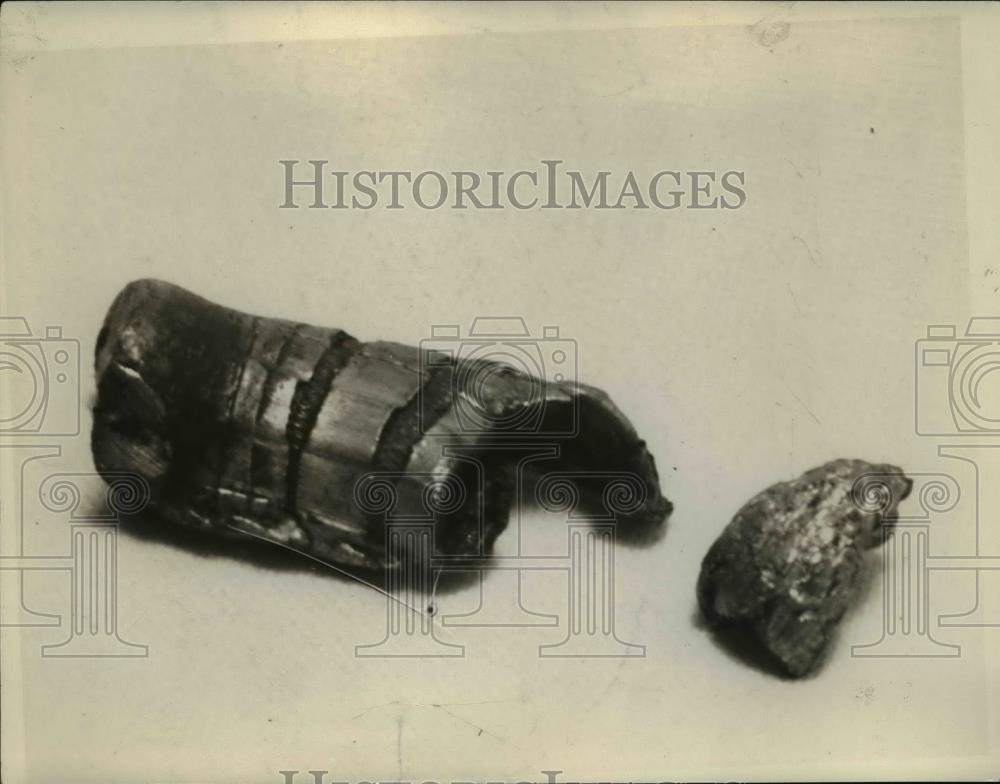 1930 Press Photo Bullet Recovered After Shooting - nee61375 - Historic Images