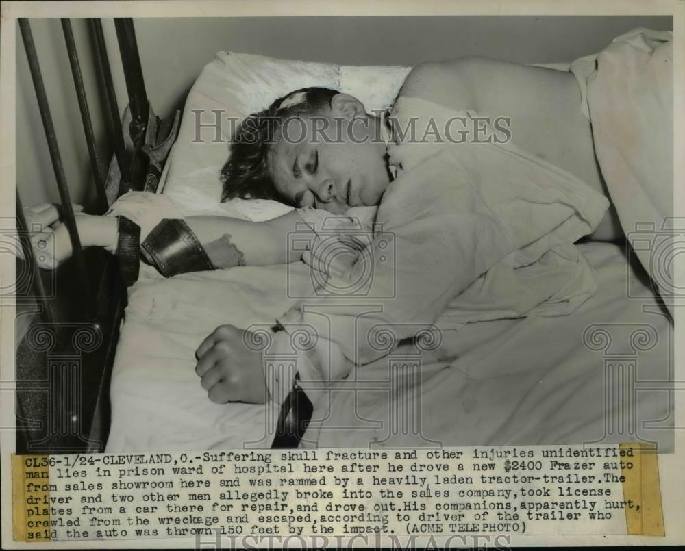 1948 Press Photo Skull Fracture patient after driving Frazer Auto Cleveland, Oh - Historic Images