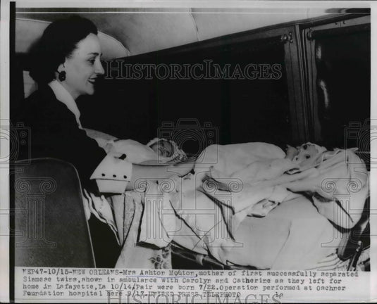 1953 Press Photo New Orleans Mrs Ashtn Mouton & separated Siamese twins - Historic Images
