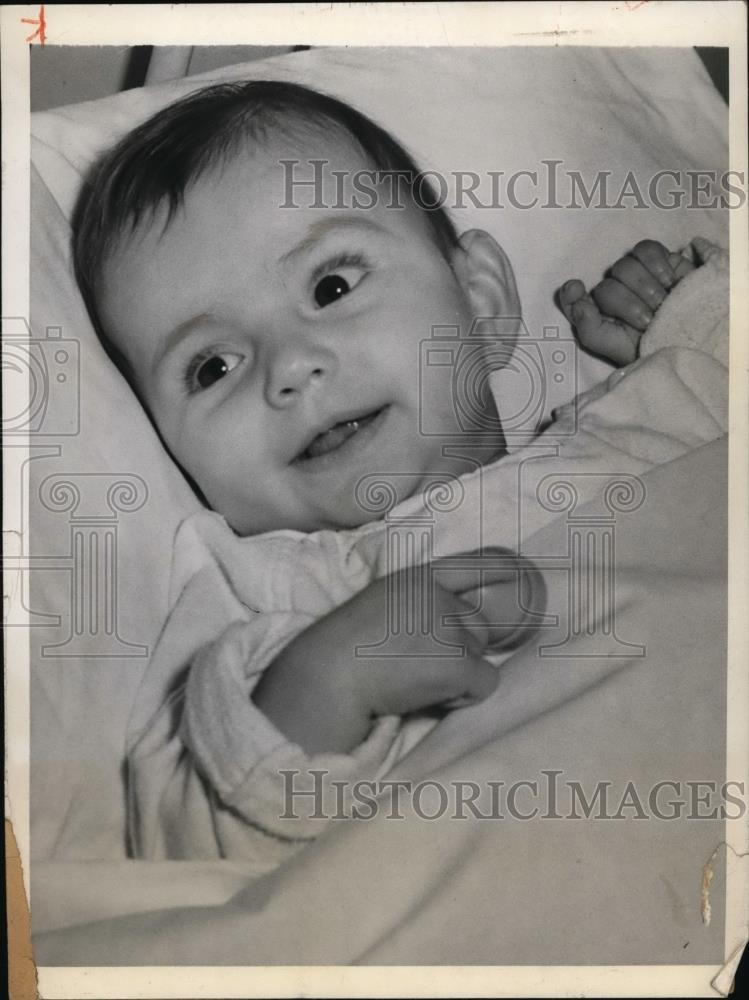 1942 Press Photo Ablene Marie Bertoni Born with Diaphragmatic 3 Surgeries - Historic Images