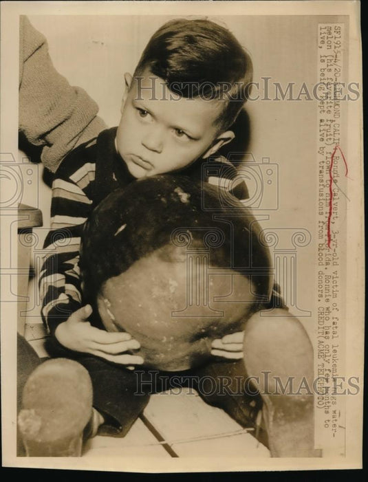 1949 Press Photo 3-Year-Old Leukemia Patient Ronnie Calvert, California - Historic Images