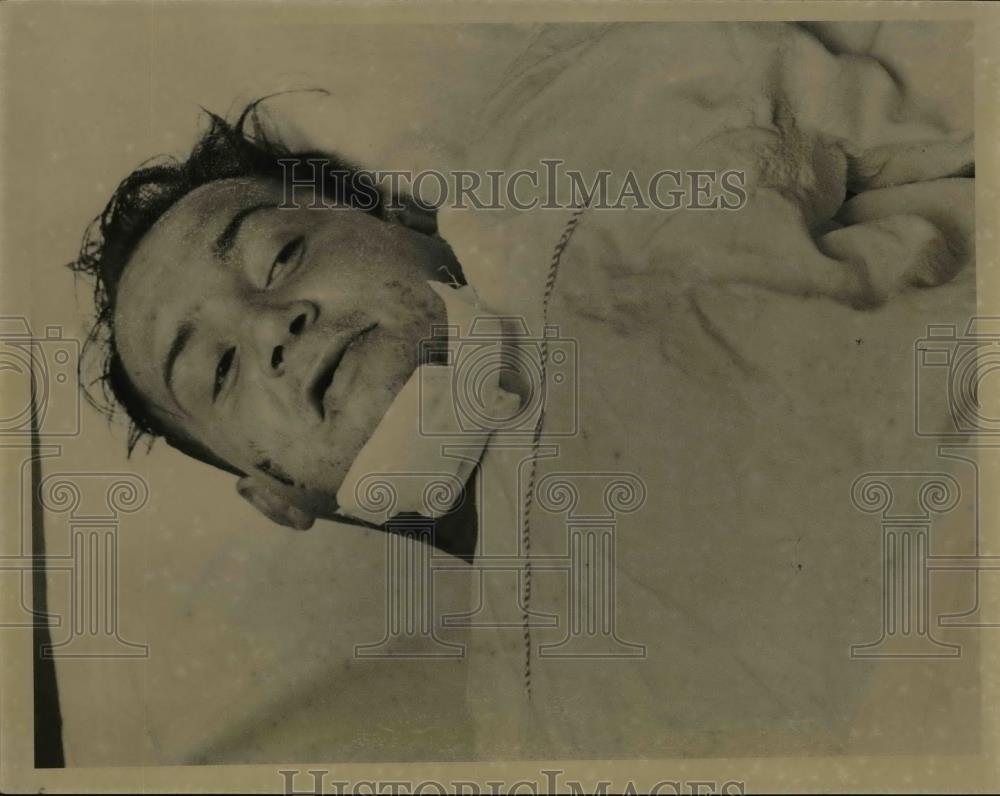 1962 Press Photo Larry Kroupa in Hospital - Historic Images