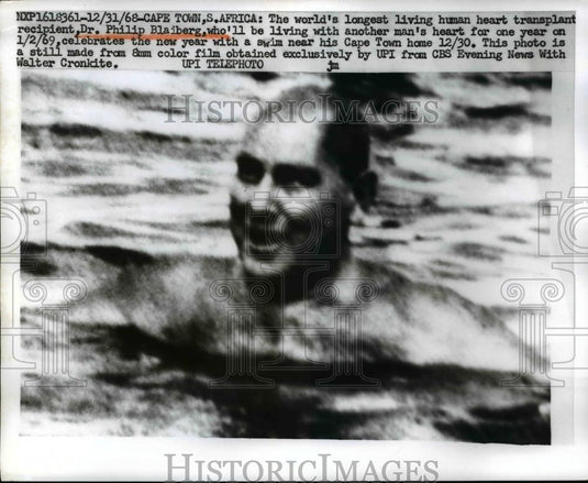 1968 Press Photo Dr Phillip Blaiberg after a heart transplant - Historic Images