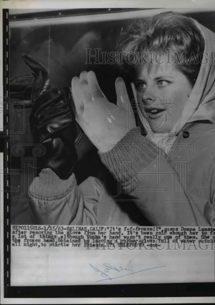 1963 Press Photo Salinas, CA: Donna Lumada showcasing frozen hand - Historic Images