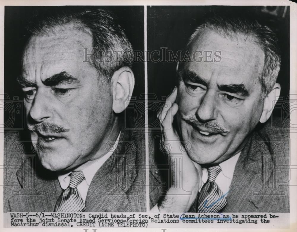 1951 Press Photo The candid faces of Secretary of State Dean Acheson at hearing - Historic Images