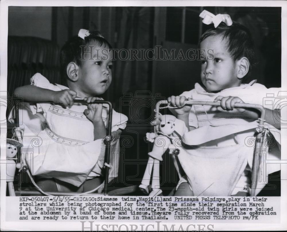 1955 Press Photo Siamese Twins Napit &amp; Prissana Polpinyo 1st Photograph Separate - Historic Images