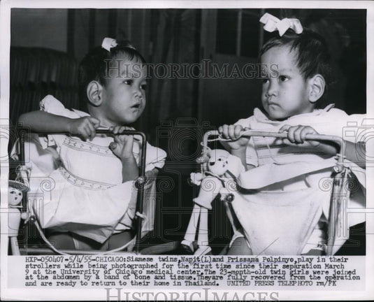 1955 Press Photo Siamese Twins Napit & Prissana Polpinyo 1st Photograph Separate - Historic Images