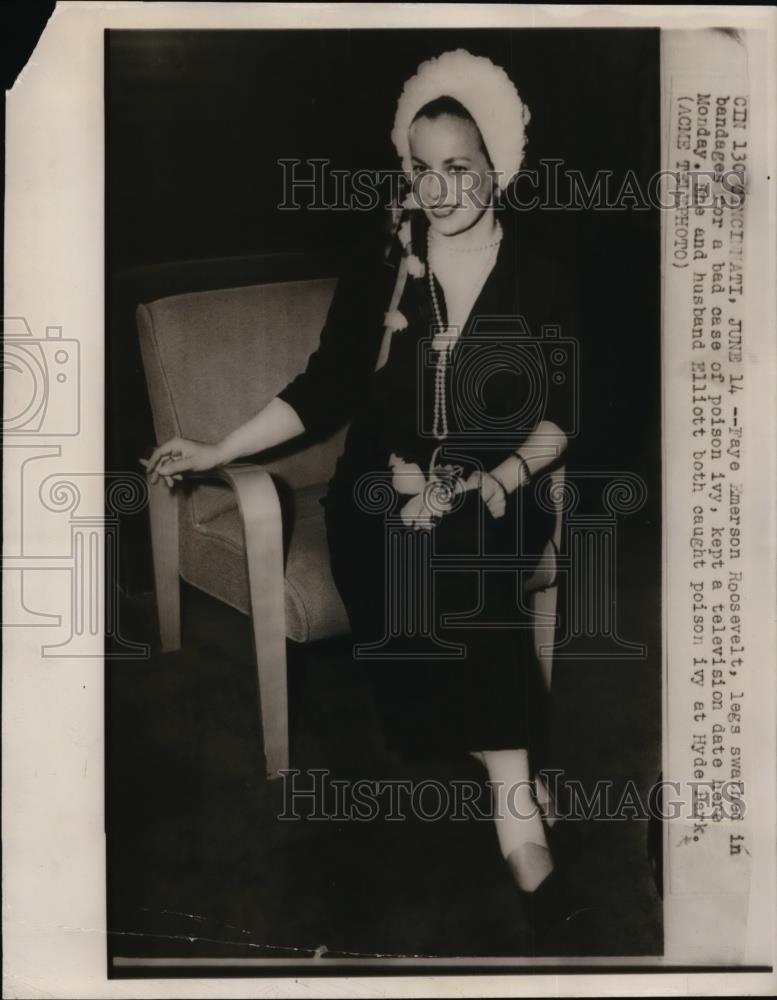 1949 Press Photo Faye Emerson Roosevelt, Poison ivy Hyde Park - Historic Images