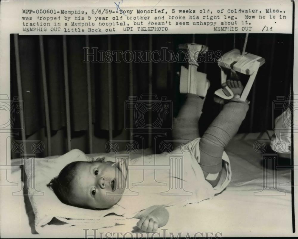 1959 Press Photo Tony Moncrief dopped by his brother and broke his right leg. - Historic Images