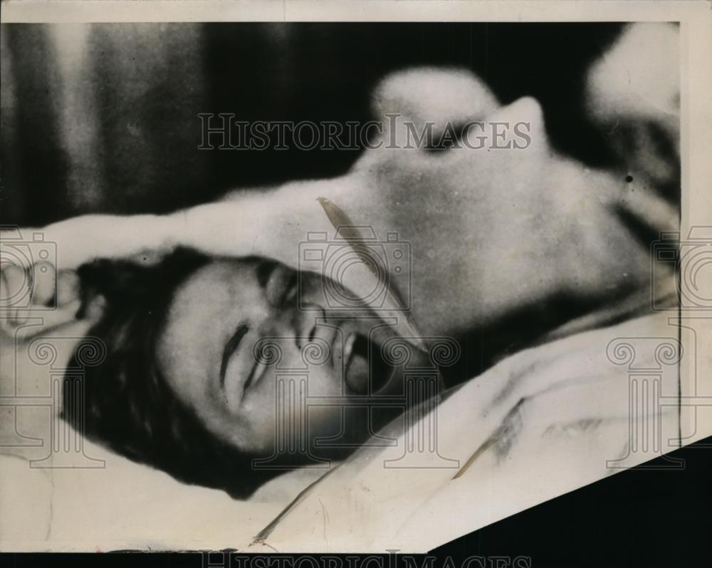 1934 Press Photo Mrs.Harld McKee of Roud Grove Ill. suffering from Yawning - Historic Images