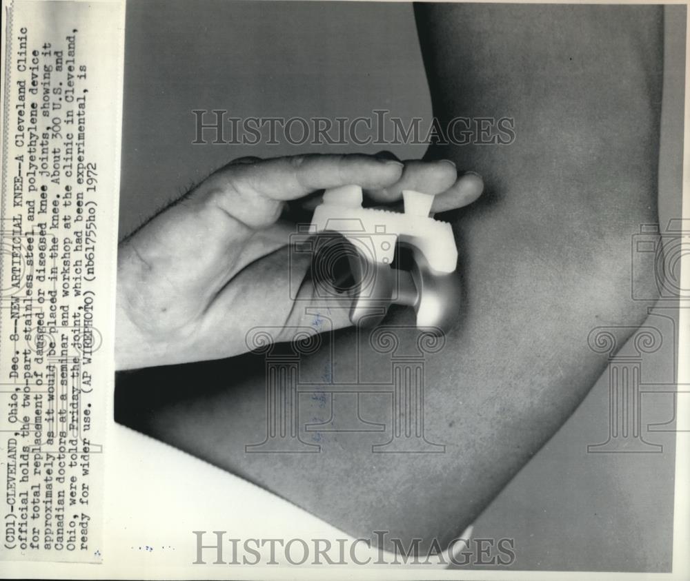 1972 Wire Photo The Cleveland Clinic official with a tw part stainless steel - Historic Images