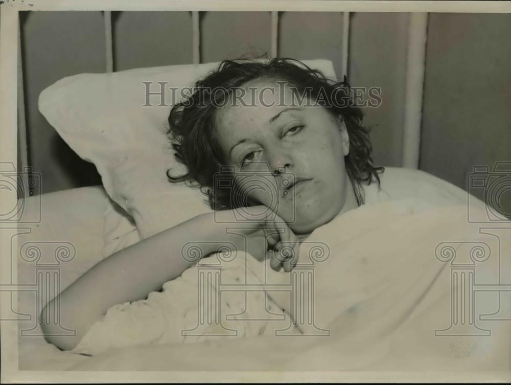 1936 Press Photo Aloa Derry, Actress attacked in her Chicago Hotel Room. - Historic Images