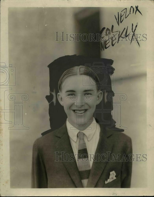 1925 Press Photo Tommy Smith Who Has $5000 Worth Of Dental Work - nee86011 - Historic Images