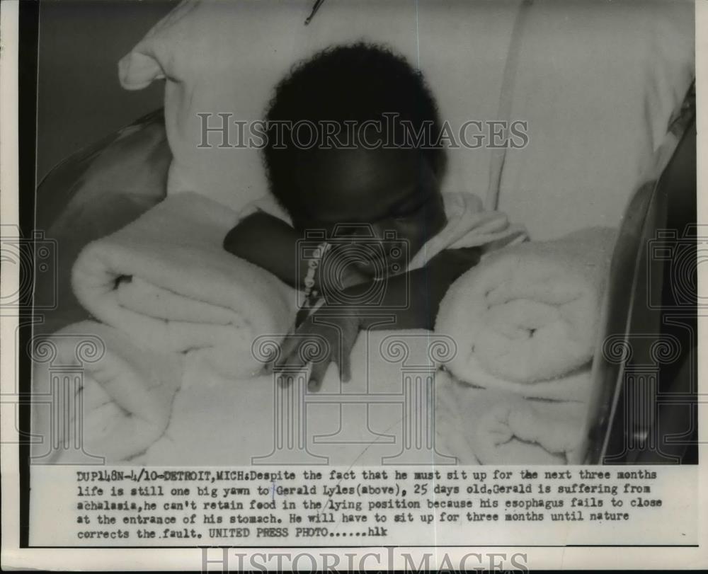 1954 Press Photo Gerald Lyles 25 days old in hospital with birth defect - Historic Images