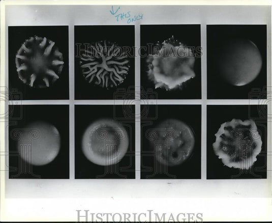 1985 Press Photo Original smooth colony of Candida albicans at left - cva82604 - Historic Images