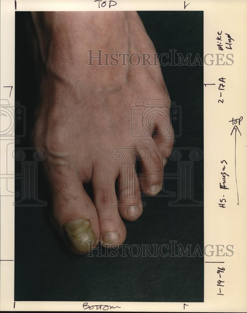 1996 Press Photo Foot - orb04287 - Historic Images