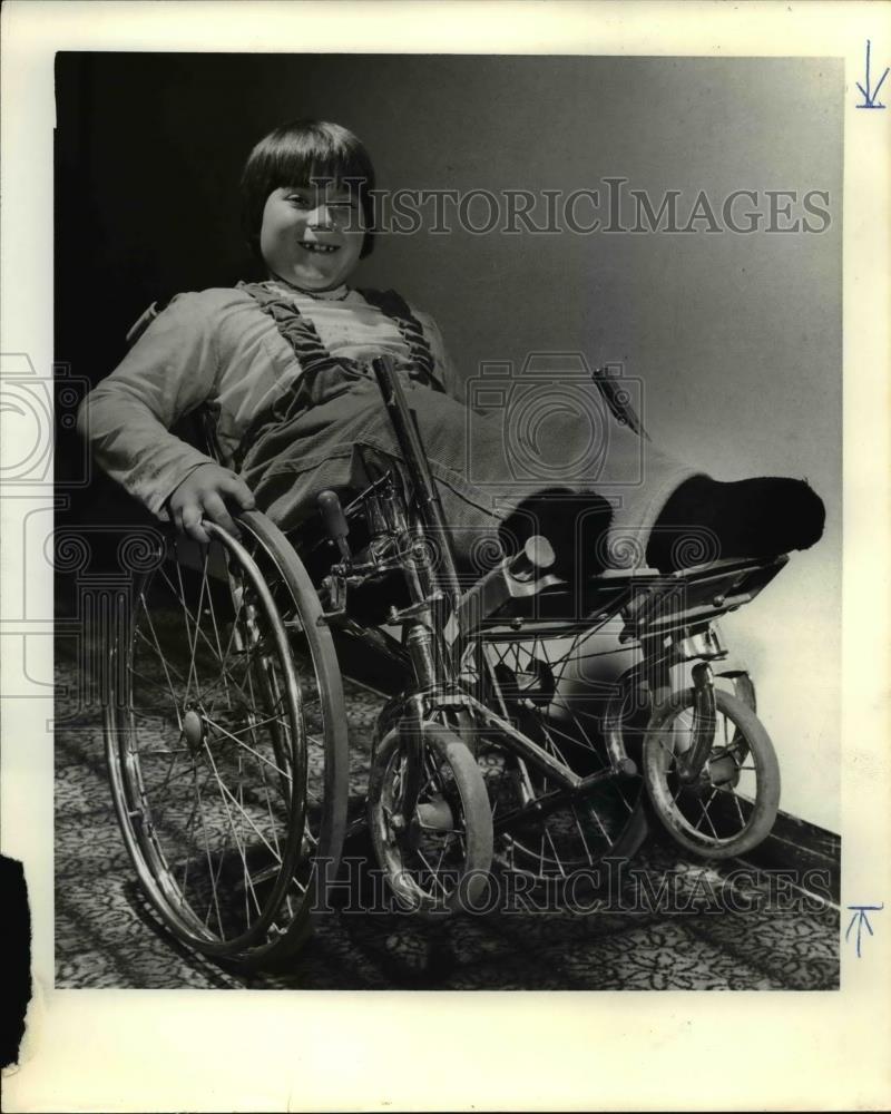1979 Press Photo Chris Wehling, 1980 Poster child for Tri county chapter - Historic Images