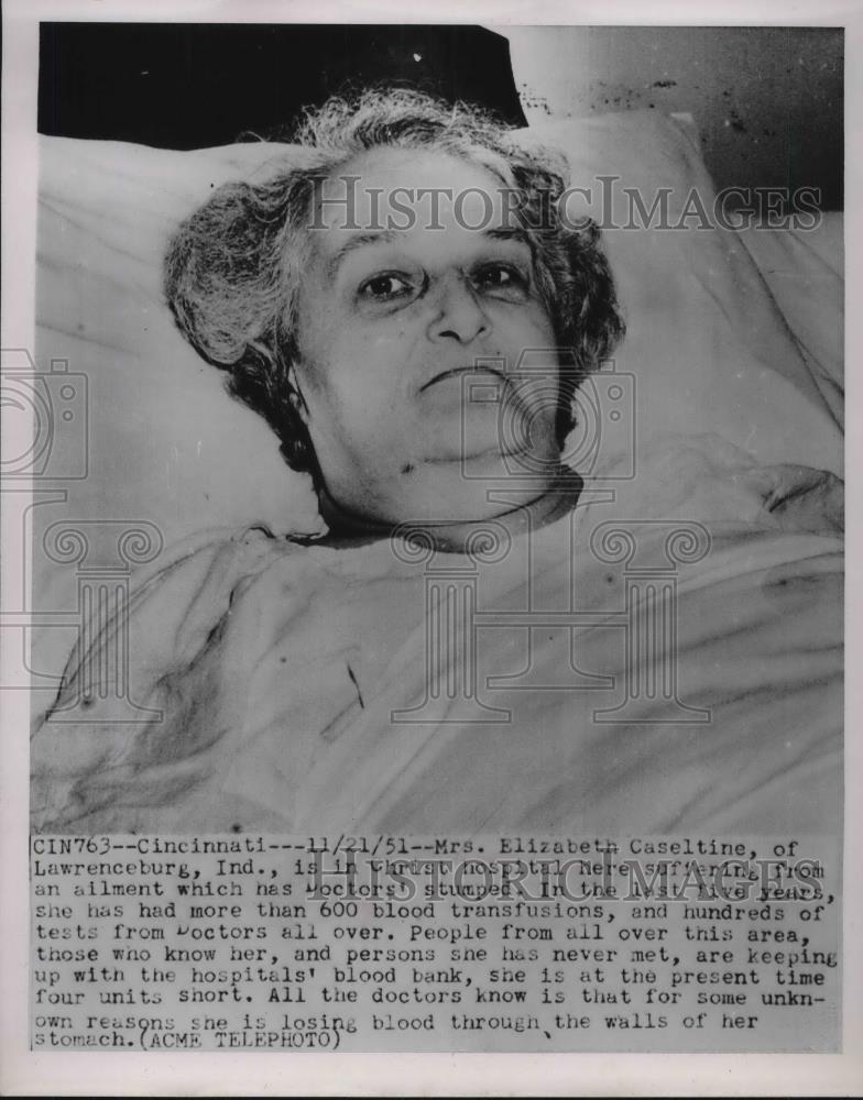 1951 Press Photo Mrs Eliza Caseltine in Cinncinati hospital 600 transfusions - Historic Images