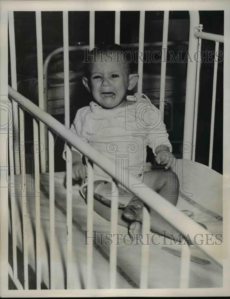 1939 Press Photo Baby Girl Burned By Father During Drunken Rage - nee95271 - Historic Images