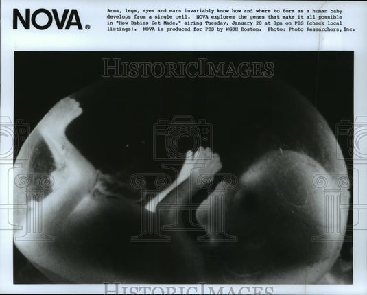 Press Photo NOVA-How Babies Get Made - cvb73662 - Historic Images