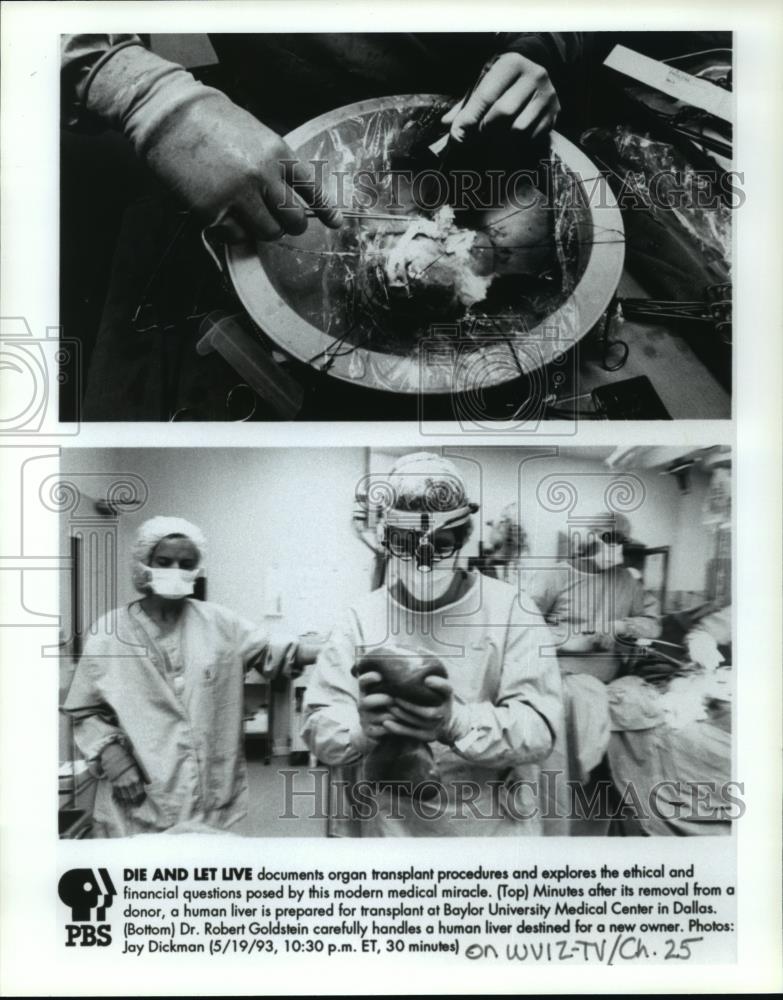 1993 Press Photo Die and Let Live documents organ transplant procedures. - Historic Images
